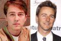 Edward Norton Plastic Surgery Before and After